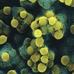 streptococcus pneumoniae